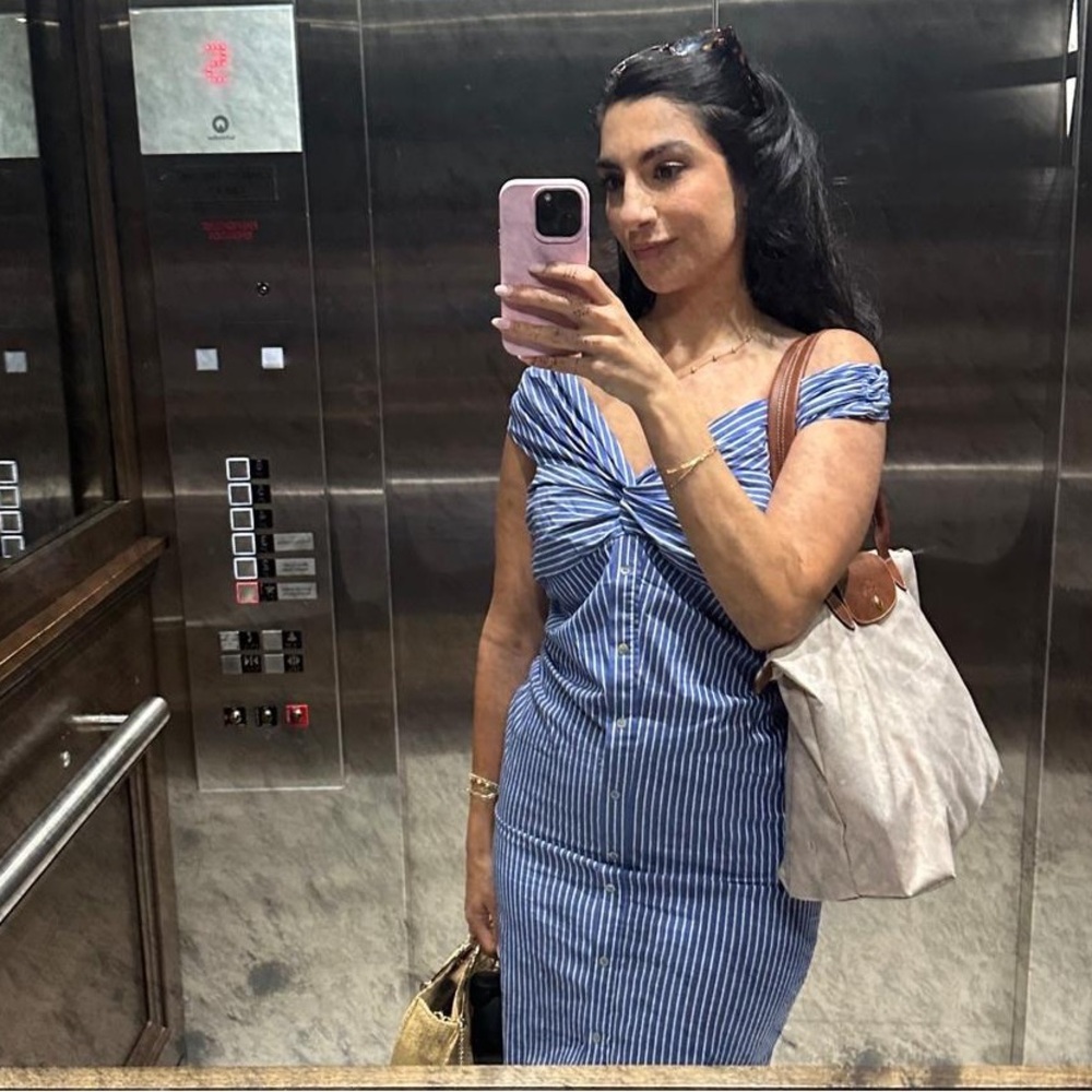 Blue and White Striped Dress